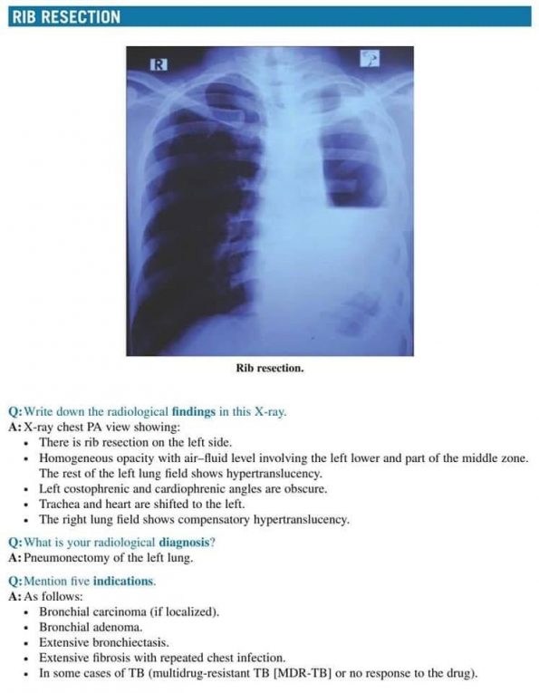 case study on x ray