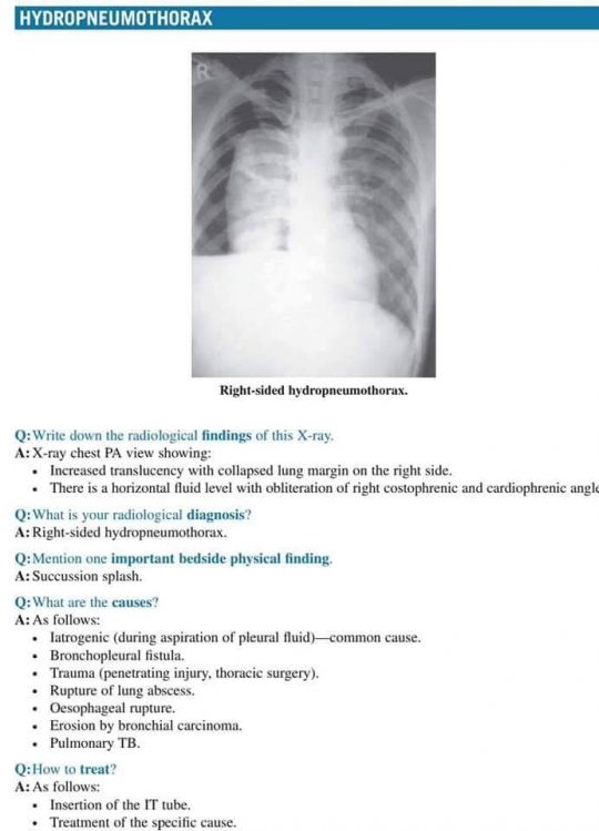 case study on x ray