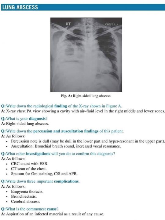 case study on x ray