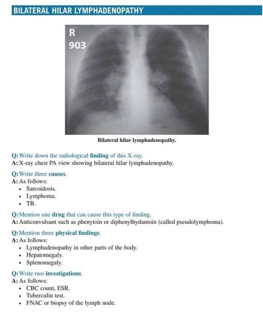 case study for x ray